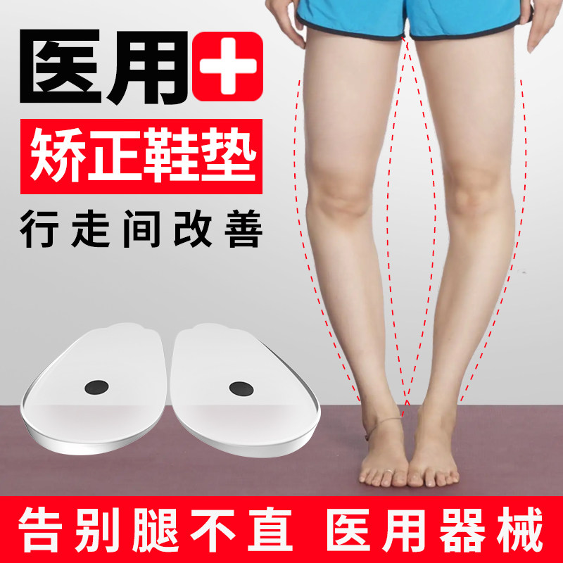 o型腿矫正鞋垫改善x小腿膝外翻直腿内外八扁平足弓神器罗圈腿纠正