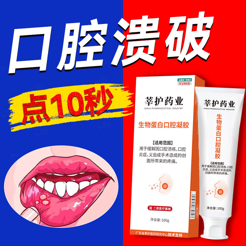 口腔溃疡专用凝胶儿童去上火一点灵创面愈合修复益生菌维生素正品