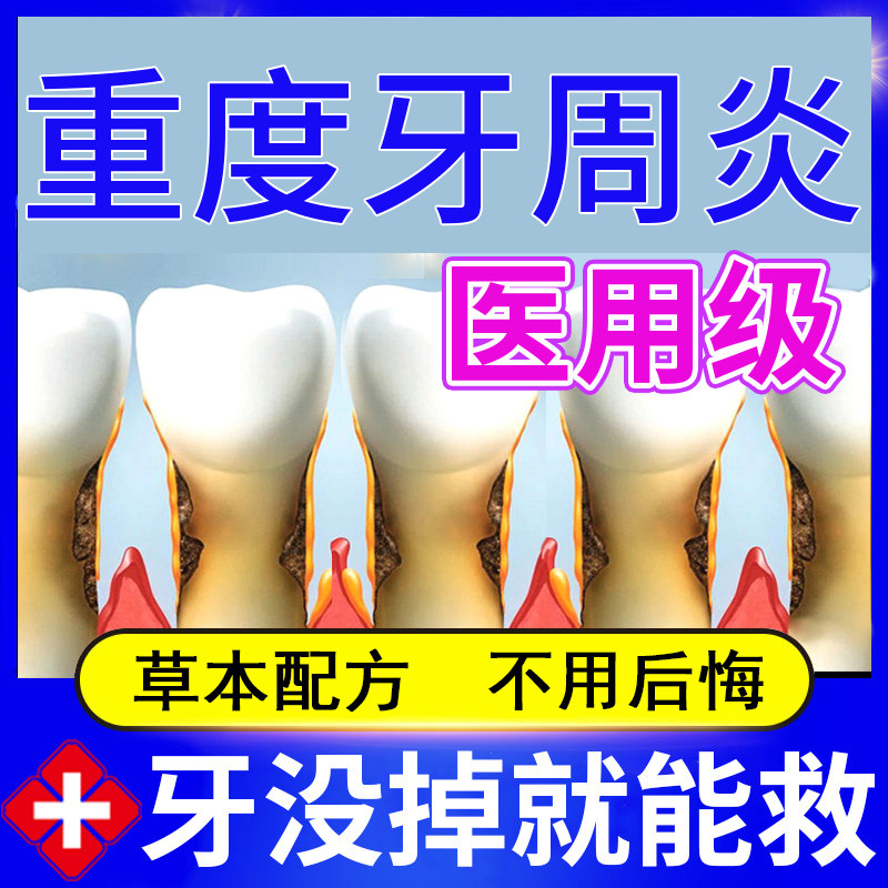 漱口水杀菌消炎牙膏官方旗舰店正品治牙痛软牙膏口腔病专业用zy