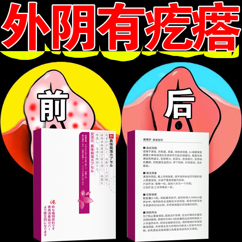 妇宁双唑泰栓消炎阴道炎妇科用药甲硝唑栓片克霉唑阴道霉