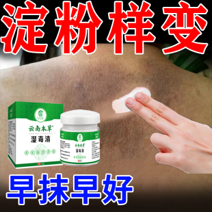 皮肤淀粉样变专用药顽固后背黑色素沉淀小腿胳膊皮肤粗糙颗粒药膏