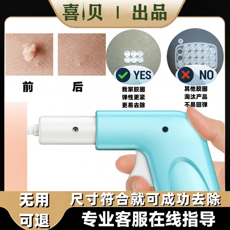 去肉球疙瘩脖子上长小肉粒物理祛除皮赘肉球去除神器工具
