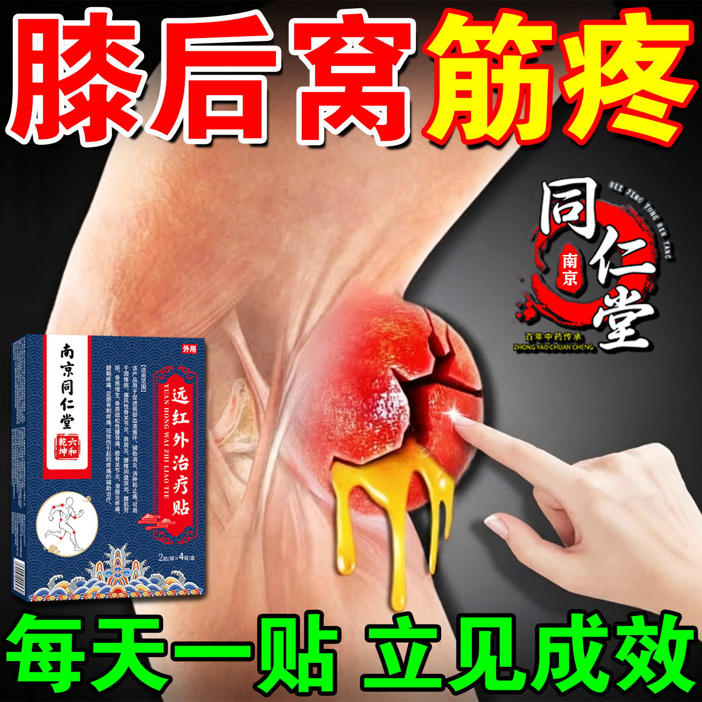 膝盖腿后窝筋疼腘窝囊肿膏药贴