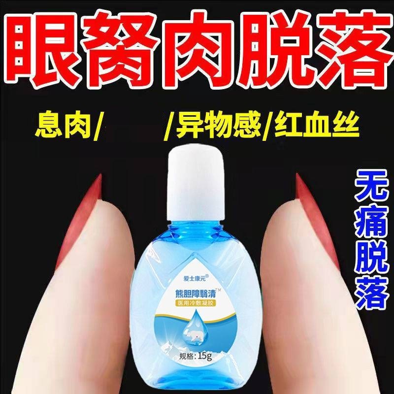 眼睛胬肉滴液去除翼状干红