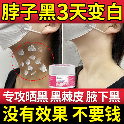 去脖子黑色素去除黑棘皮症淀黑色素沉白磨砂药膏腋下去黑美霜神器