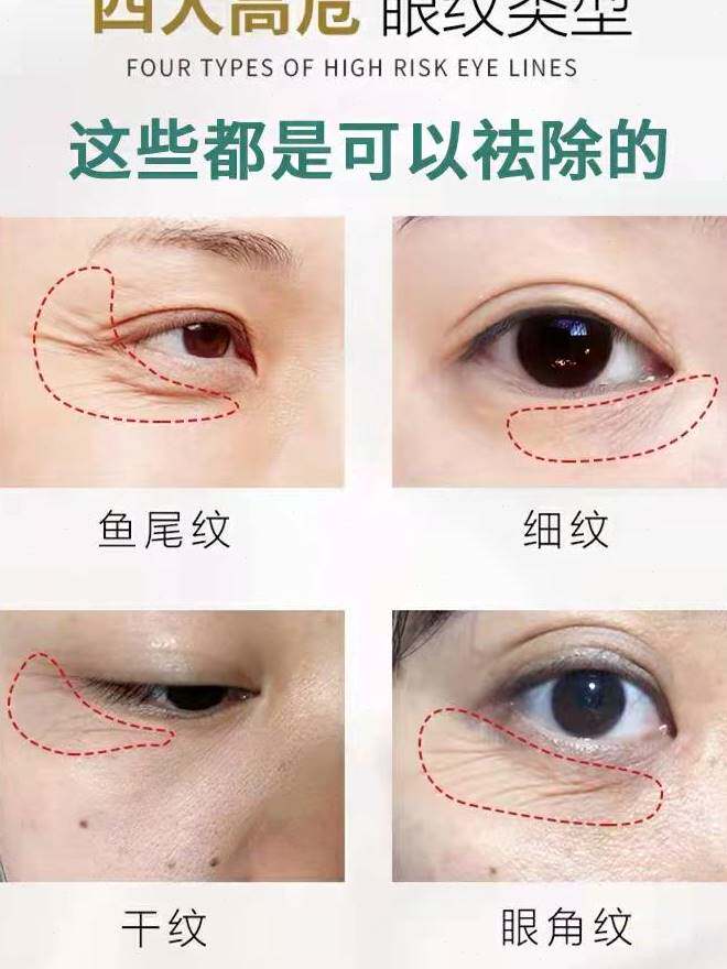 眼霜抗皱去细纹眼角皱纹修复提拉紧致抗老淡化眼部眼纹鱼尾纹除皱