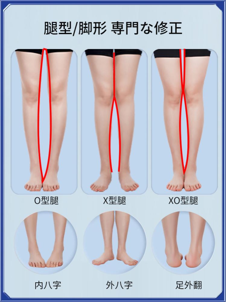 【日本骨グ科専研】O型X型小腿外翻矫正腿型直腿矫正鞋垫男女可用