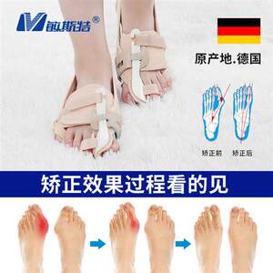敏斯特脚趾矫正器大拇指外翻分趾器女脚骨姆趾头可以穿鞋纠正脚型