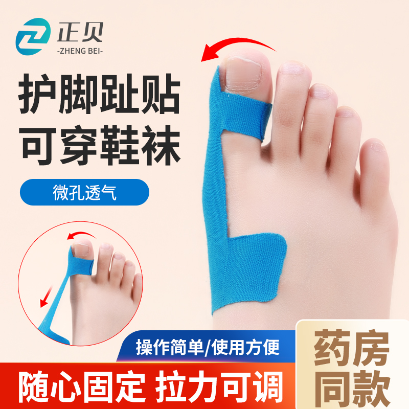 正贝拇指外翻肌贴拇外翻矫正器