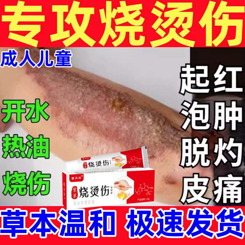 紫草烧伤膏成人烧伤烫伤起泡黑印去疤膏快速修复高温油开水烫伤膏