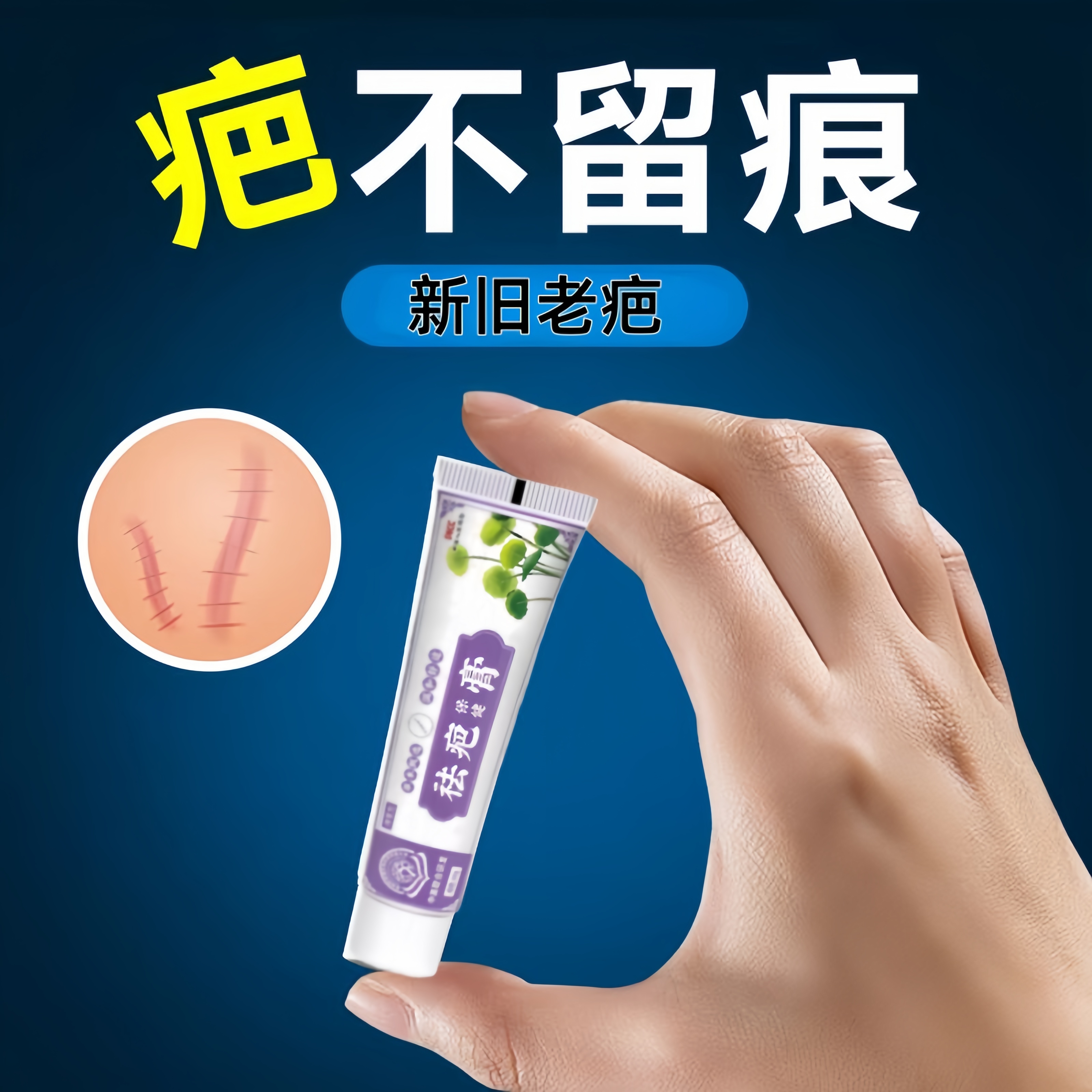 疤痕修复去疤膏增生剖腹产凸起瘢疙瘩手术烫伤去除淡化除疤祛疤膏