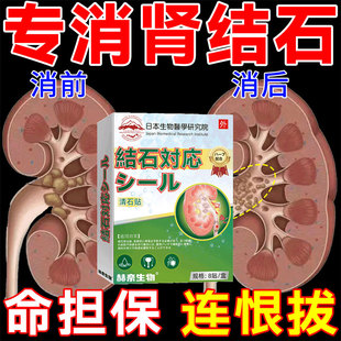 鸡内金肾结石排石专用/药金钱草中草药肾结石化石溶石排石/药