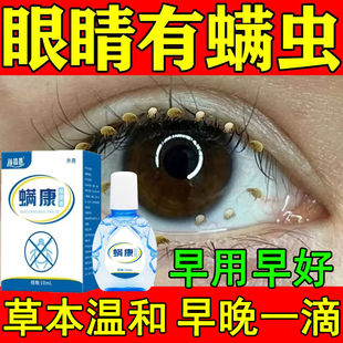 眼睛除螨眼药水去眼角干涩视线模糊去异物感螨虫清洁专用螨康液