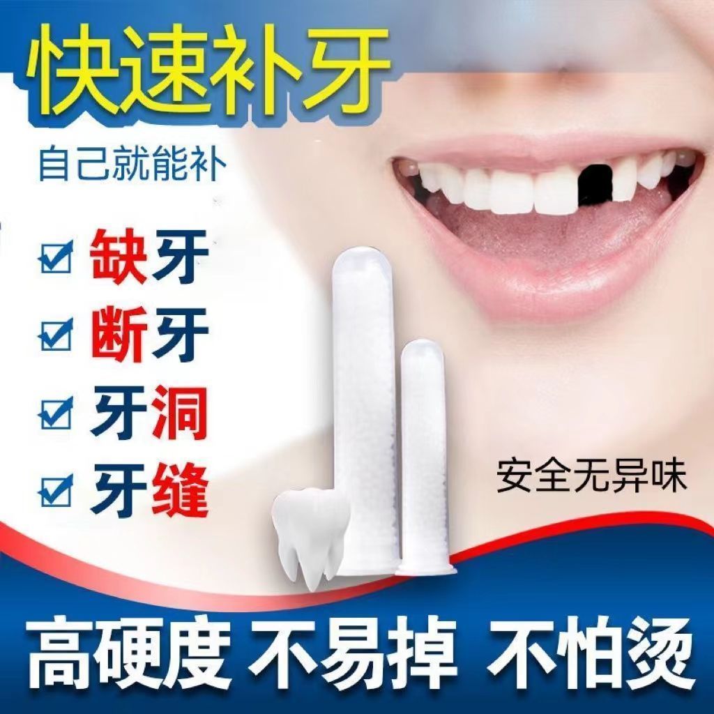 新型临时假牙材料自制补牙神器补牙缝牙齿材料义齿假牙材料补门牙