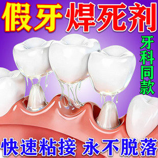 假牙粘合剂医粘牙用胶水烤瓷牙稳固定假牙树脂牙齿冠松动粘接剂b