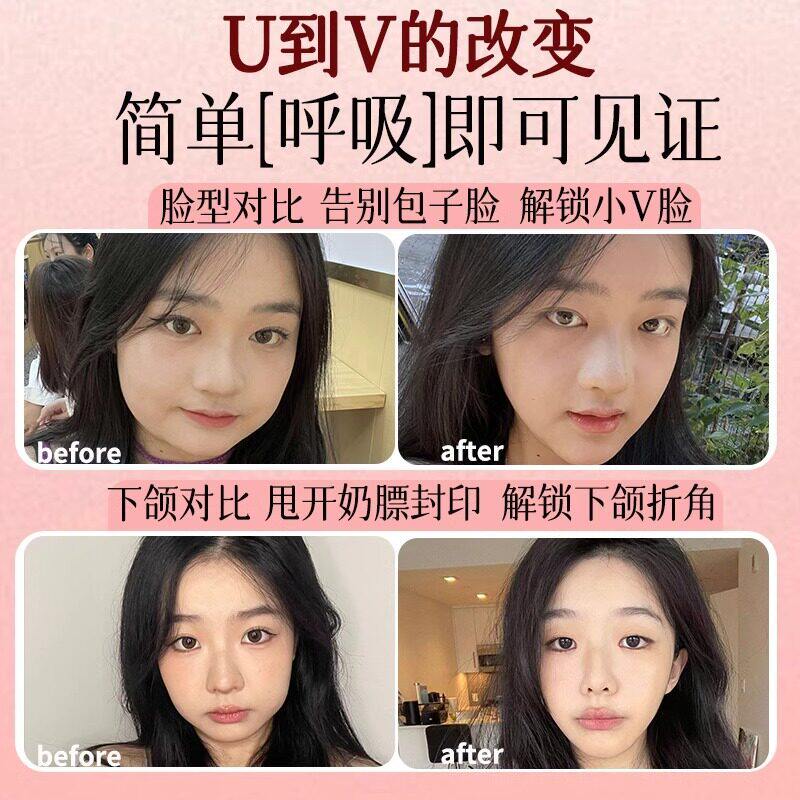 【日本专研】法令纹消除神器提拉紧致面部提升V脸瘦脸咬肌仪