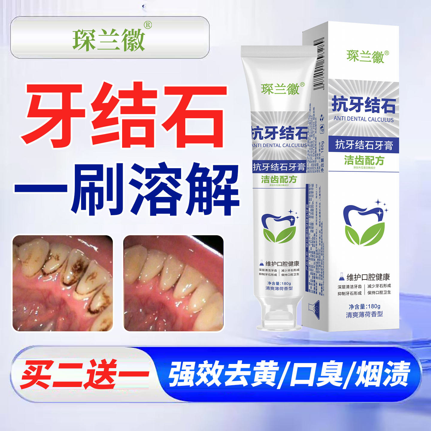医用去牙结石溶解牙石牙垢速效清理去黄口臭烟渍美白神器牙膏