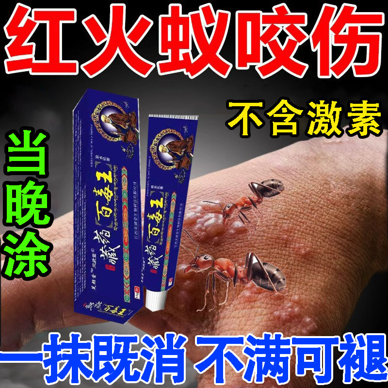 红火蚁蚂蚁咬伤药膏蚊虫叮咬隐翅虫毒虫跳蚤螨虫叮咬消肿外用