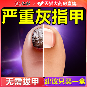 灰指甲治疗专用药正品旗舰店非特效一滴净药水脚气止痒脱皮杀菌BF