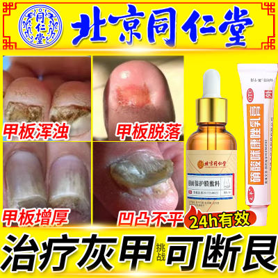 专治疗灰指甲专用药药膏药水正品旗舰店甲癣甲沟炎脚气非特效根BF