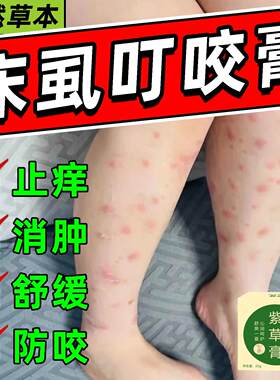 床虱叮咬药膏被咬了之后止痒消肿舒缓膏瘙炎专用青紫草膏跳蚤臭虫