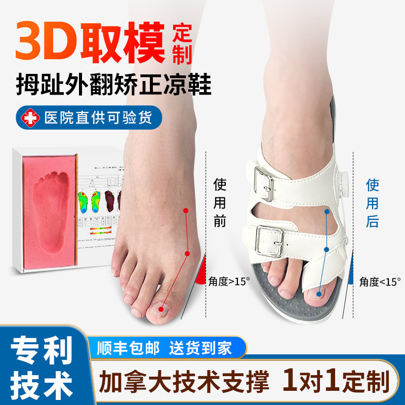bioped3D定制拇指外翻矫正器大脚趾骨扁平足外翻足弓矫正拖鞋凉鞋