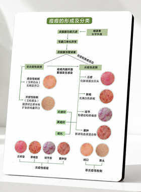 痘痘的形成及分类科普展示牌美容院皮肤管理桌面装饰摆件