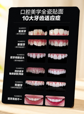 口腔美学全瓷贴面十大适应症展示牌牙科诊所桌面装饰摆件
