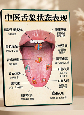 中医舌象状态表现科普装饰摆件中医馆养生馆前台桌面装饰摆牌