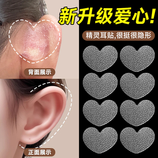 磨砂精灵耳贴心型强支撑升级隐形耳朵立体贴无痛招风耳显脸小神器