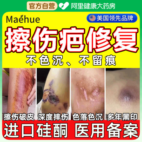 擦伤疤痕修复膏摔伤除疤去黑色素沉淀敷料小孩儿童脸部祛疤专用