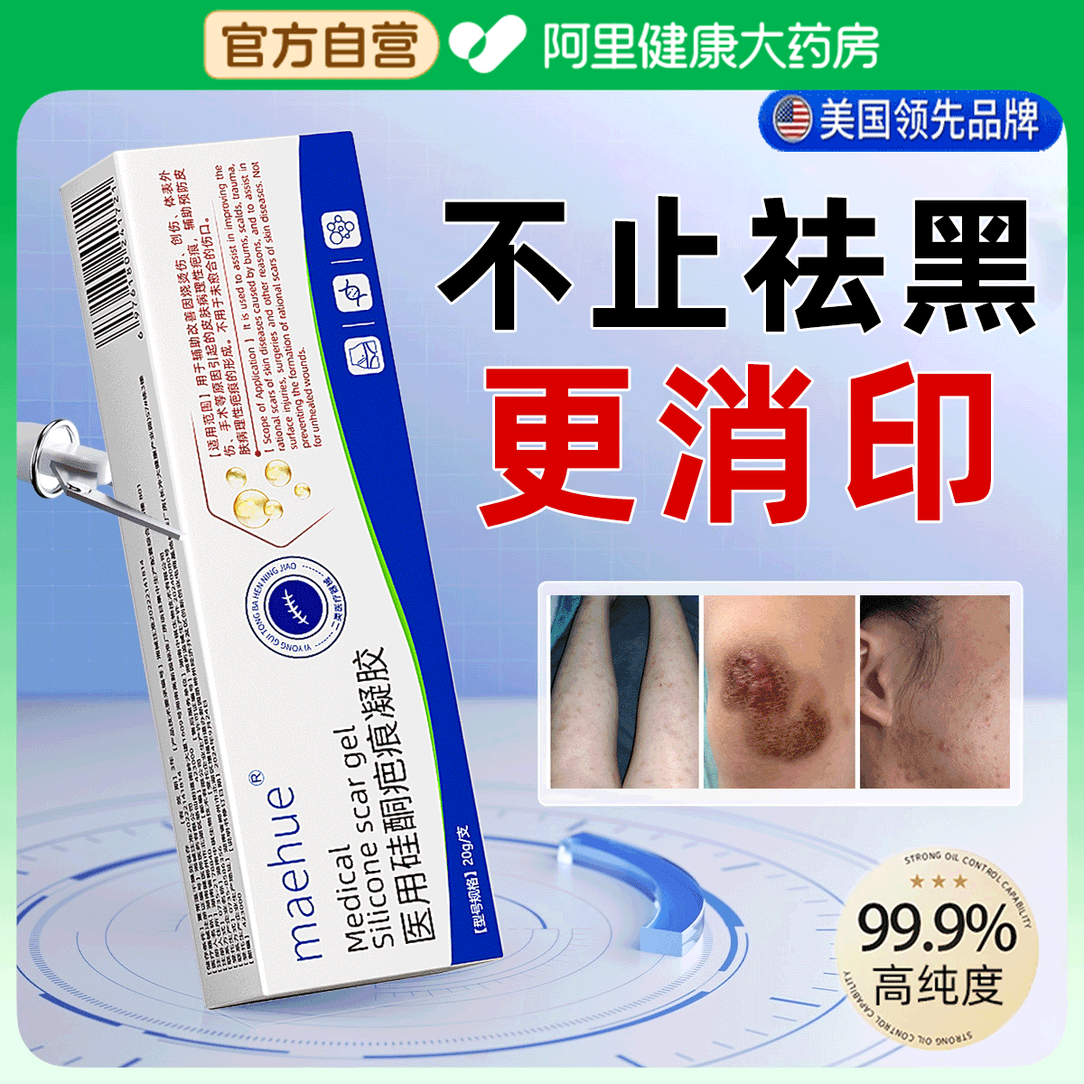 去疤印去黑色素沉淀药膏淡化疤痕去除儿童痘印祛疤膏后背脸上伤疤