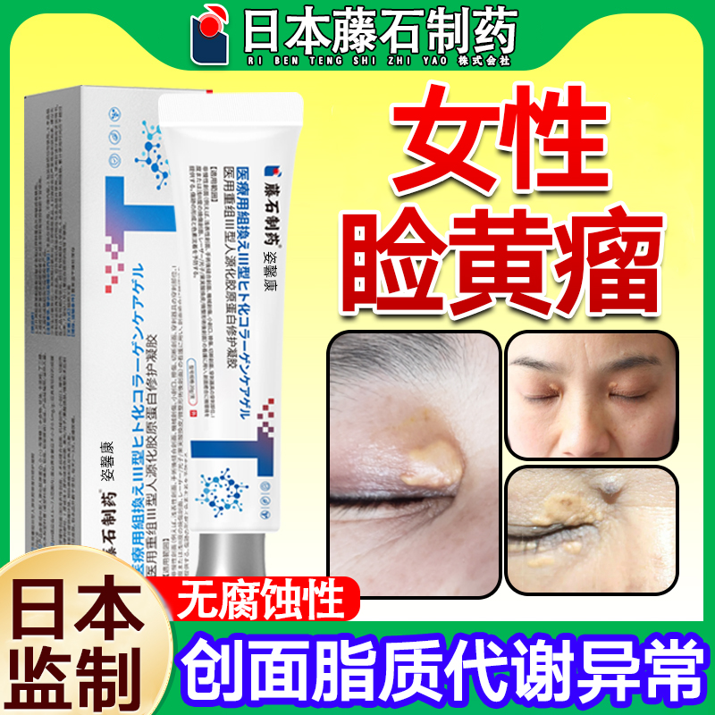 睑黄瘤脂肪粒汗管瘤药监备案