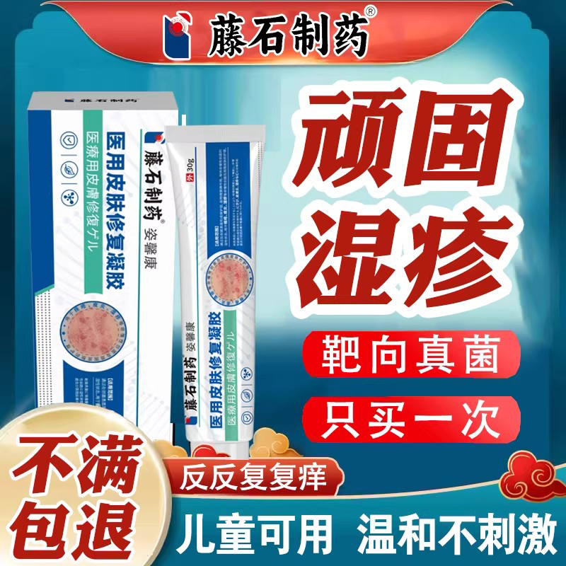 湿毒清软膏热毒湿疹止痒治祛去克星皮肤专用疗癣根外用顽固皮炎xj