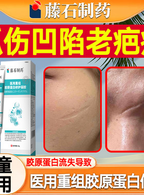 去疤膏抓伤生长因子修凹陷性面部划伤疤痕填充长肉复除疤祛疤膏xj