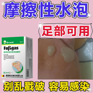 脚底摩擦起去水泡湿止痒专脚气脱皮杀菌疹臭真菌感染用出汗喷剂mf