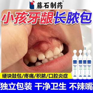 儿童牙龈脓包上火肿痛小孩牙周根发炎智齿红肿鼓包硬块护理喷剂wg