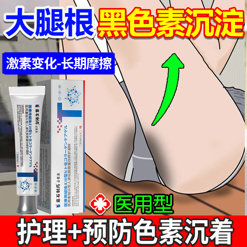 大腿内侧黑色素沉淀去除专用软膏私处粉嫩私密处美白淡化医用型lx