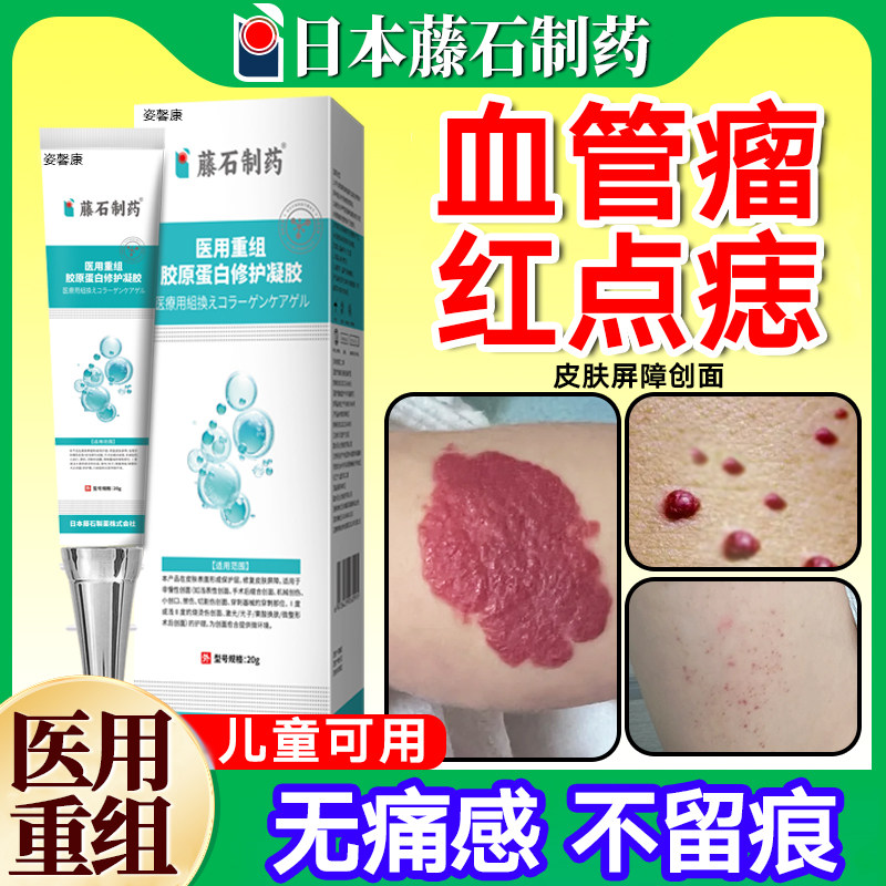 【监制】血管瘤血管痣官方膏