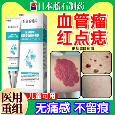 【日本监制】血管瘤血管痣官方膏