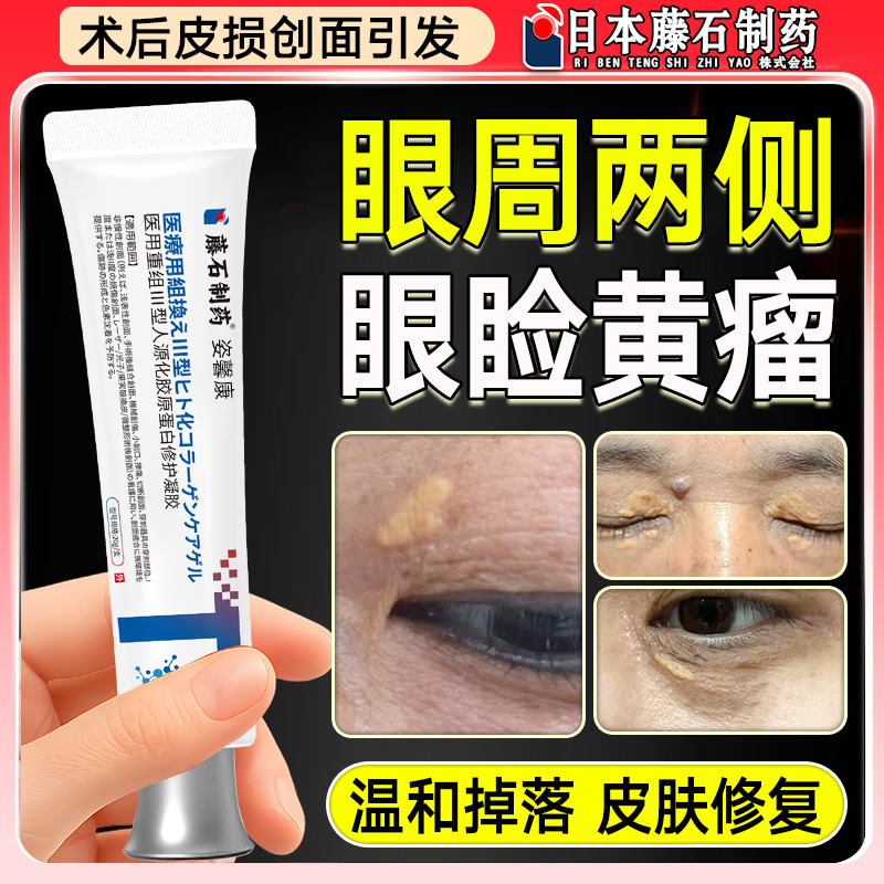 睑黄瘤膏去除睑部黄疣眼睑黄瘤除眼角黄斑睑黄疣汗管药监备案膏hy
