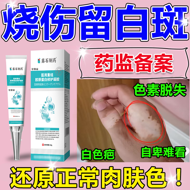 烫伤烧伤白色斑去除疤痕修增生凹陷凸复色素脱失硅酮医用除疤膏wg