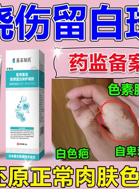 烫伤烧伤白色斑去除疤痕修增生凹陷凸复色素脱失硅酮医用除疤膏wg