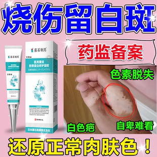 烫伤烧伤白色斑去除疤痕修增生凹陷凸复色素脱失硅酮医用除疤膏wg