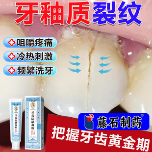 牙釉质隐裂纹斑脱损伤用修牙齿裂缝修补复咬合无力疼痛医用牙膏wg