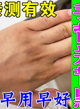 手背关节黑去手指关节发黑皱纹祛除手纹手肘膝盖黑色素沉淀磨砂膏