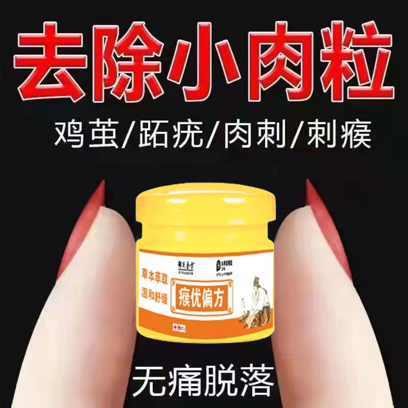 疣瘊肉粒一抹无忧瘊子肉刺扁平尤无痛去脖子小肉粒丝状尤黑痣特效