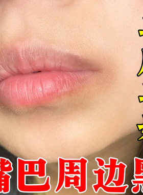 嘴角发黑改善唇周黑印暗沉儿童去除淡化嘴巴周边黑色素沉淀专用膏