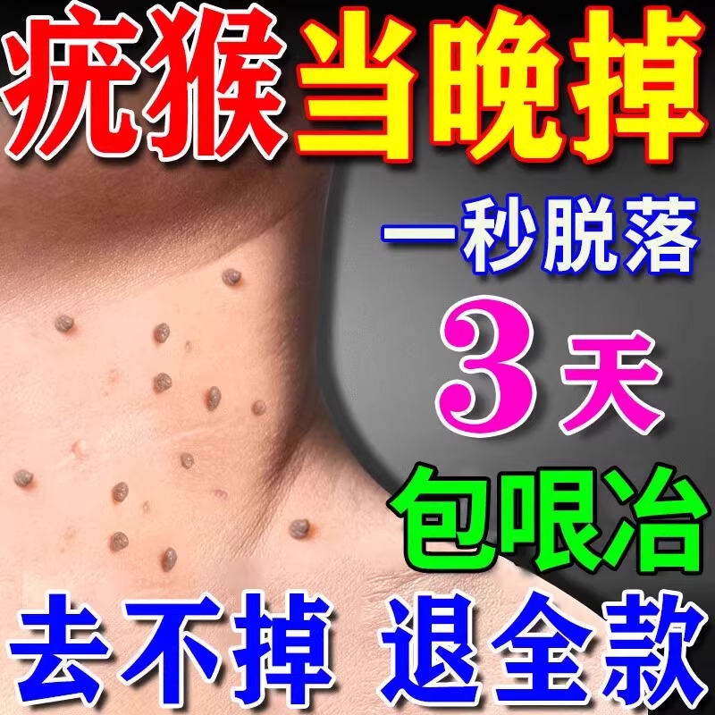 脖子上小肉球肉粒肉刺疙瘩赘肉丝状疣瘊子去