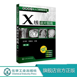 包括一些少见病便于拓展影像诊断思路 全面覆盖基层常见病及多发病中枢神经系统与头颈部读片基础同时也 X线读片指南 第二版